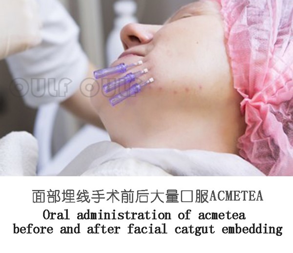 爆炸线填充什么？真的有这么神吗？(图3)