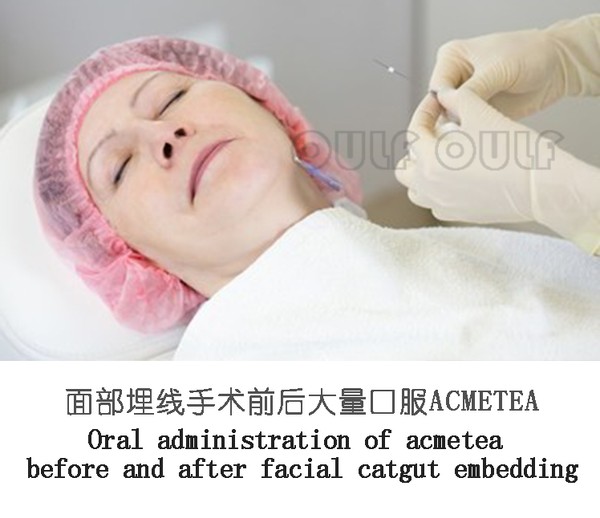 爆炸线填充什么？真的有这么神吗？(图2)