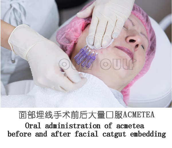 爆炸线填充什么？真的有这么神吗？(图4)