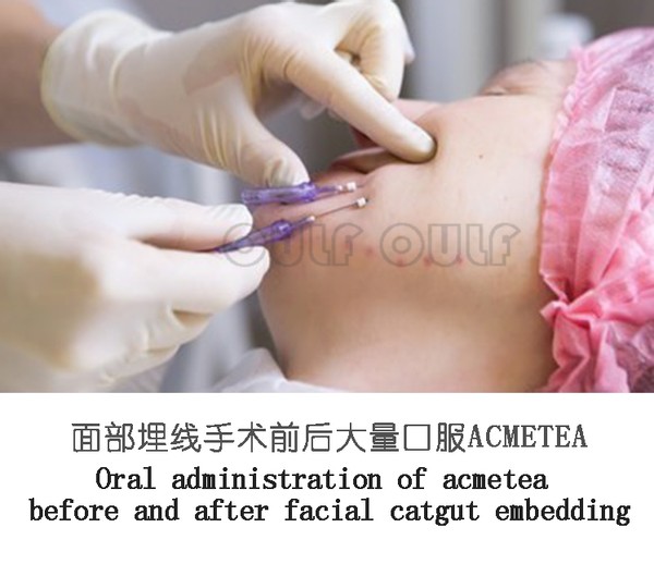 爆炸线填充什么？真的有这么神吗？(图1)